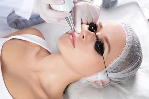 Laser Rejuvenation (Wajah)